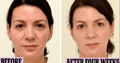 WOW: she drinks nothing but water for a month and this is what happens