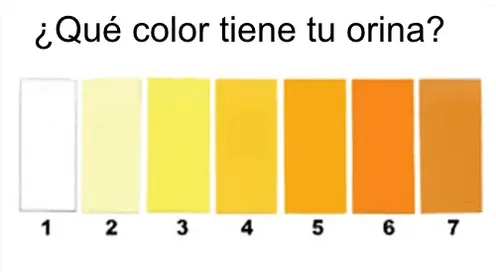 Esto dice el color de tu orina sobre tu salud