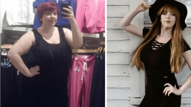 Bizar! Deze vader geeft 34.000 dollar aan zijn dochter voor plastische chirurgie! "De jongens zien me nu ineens wel staan!"