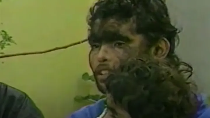 20 People With Unique Genetic Traits That Are Hard to Forget