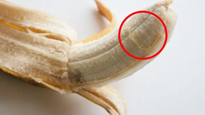 Die Fäden an der Banane? Die haben einen Namen und eine Aufgabe!