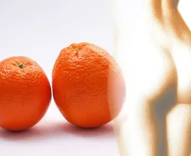 Willst du deine Cellulite loswerden? Diese Tipps können helfen