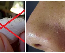 Home spa day! If you try this cheap and natural skin cleanser you'll never buy nose strips again!