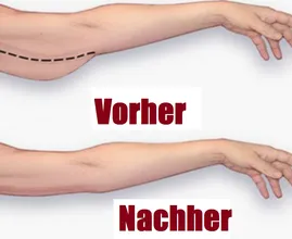 Hast du auch 'Schwabbelarme'? Diese 3-Minuten-Übung hilft wirklich.