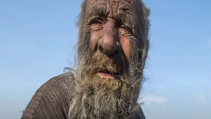Ewww! This Man Hasn’t Taken A Bath In 65 Years