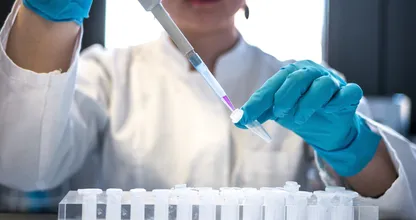 Neuer bestätigter Fall einer von HIV geheilten Person