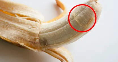 Ces petits fils ennuyeux sur les bananes… Ils ont un nom ET un but !