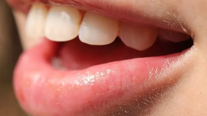 This is how you can soothe a burnt tongue within 10 seconds