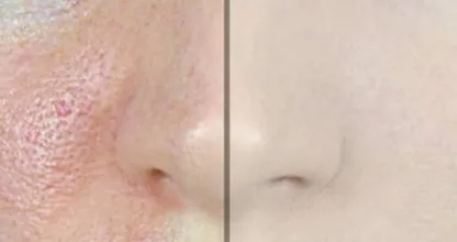 Wow, ze doet een trucje met haar make-up kwast en haar poriën verdwijnen! Dit kan iedereen!