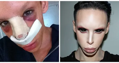 Vinny (22) wil zich laten ombouwen tot genderneutrale alien:  ,,Ik zou niet weten waarom ik niet níéts zou kunnen hebben, daar beneden!'