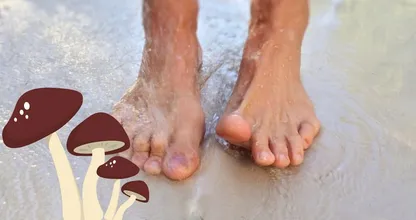 Hast du Nagelpilz? Mische diese Zutaten zusammen, um ihn loszuwerden!