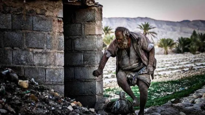 Beurk ! Cet homme n'a pas pris de bain depuis 65 ans