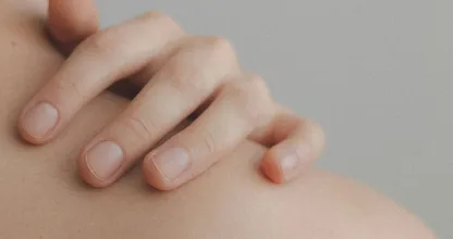 Eczeem? Deze voedingsmiddelen kunnen het veroorzaken