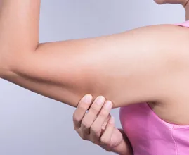 Hast du auch Hängearme? Dann solltest du diese 3 Übung machen.