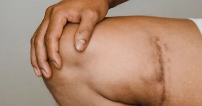 Op deze manieren kun je pijnlijke knieën versterken en ontlasten