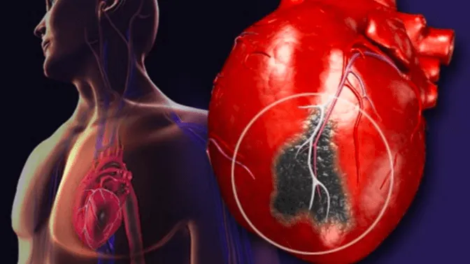 DIT zijn de zes voedingsmiddelen die cardiologen liever vermijden.. Dit wisten we nog niet!