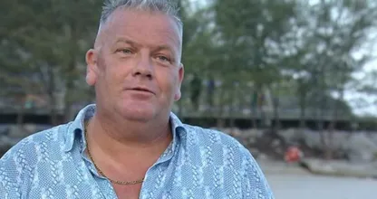 B&B Vol Liefde-Martijn openhartig over litteken op gezicht