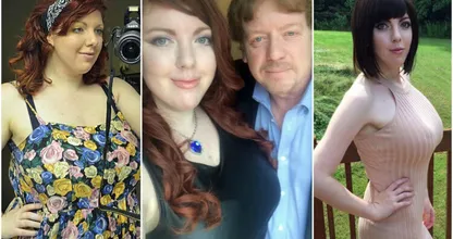 Bizar! Deze vader geeft 34.000 dollar aan zijn dochter voor plastische chirurgie! "De jongens zien me nu ineens wel staan!"
