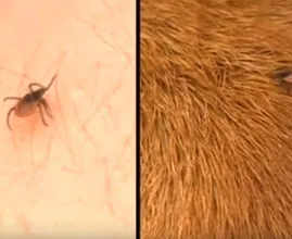 Was hilft gegen Zecken? Diese 3 Dinge helfen bei einer Zecke (Hund, Katze und Mensch)