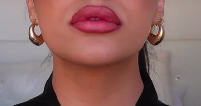 Teenagers try this bizarre trend for fuller lips