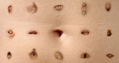 Warum der Bauchnabel der schmutzigste Ort deines Körpers ist!