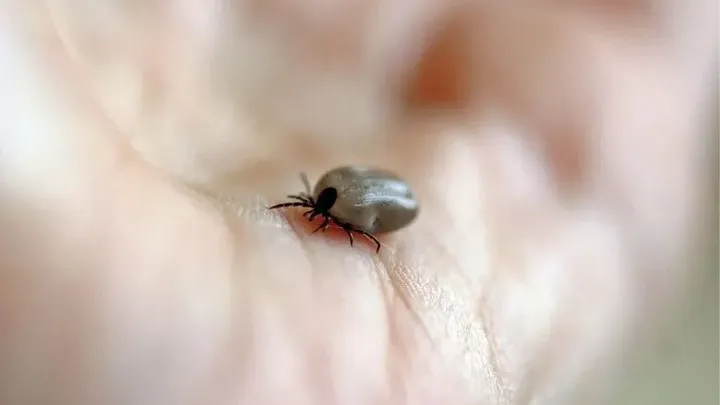 This is how you remove ticks safely!