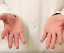 Voorkom zweethanden door altijd dit product bij de hand te hebben