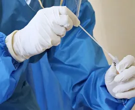 Er komt waarschijnlijk een PCR-test voor schurft