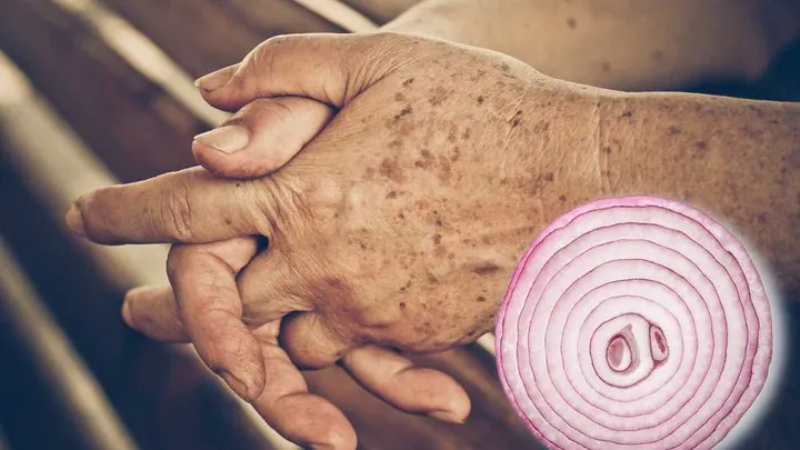 Do you have age spots on your skin? This simple trick can help you reduce them in no time!