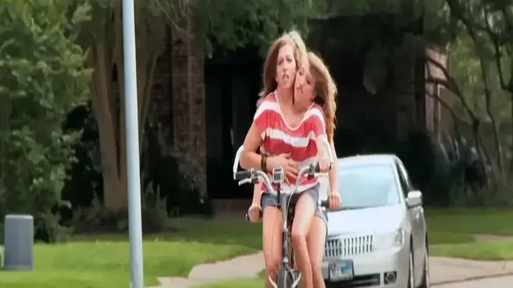 Years After These Siamese Twins Were Born, They Have Something To Share