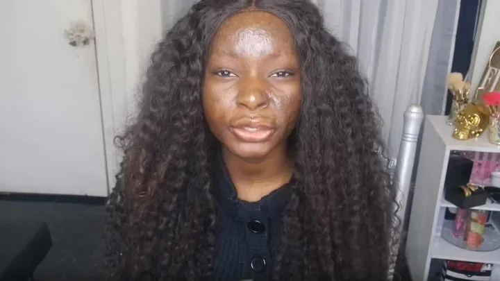 Deze bekende Amerikaanse beautyblogger met brandwonden laat zien wat je met make-up allemaal kunt doen! Dit is zo inspirerend!
