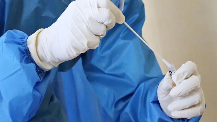Er komt waarschijnlijk een PCR-test voor schurft