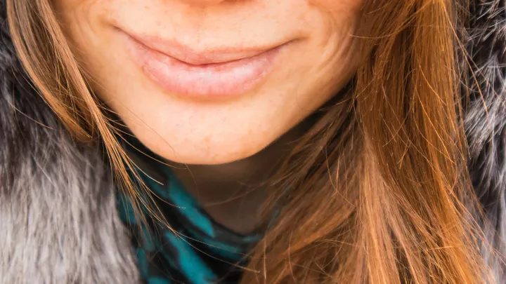 Witte velletjes op je lippen? Dan ben je misschien allergisch voor dít alledaags product