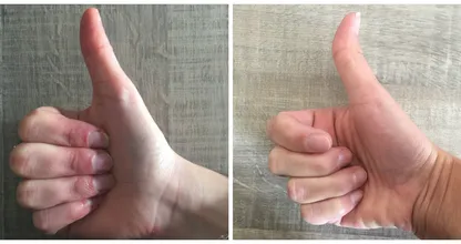Is your thumb straight or crooked? This is what it can tell you about your personality!