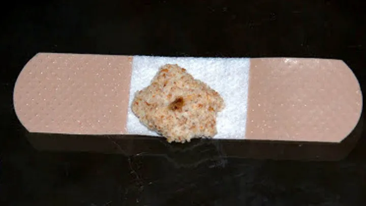 She puts a piece of bread on her child's plaster for a trick we didn't know yet!
