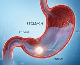 Secondo i ricercatori, in questa posizione il paracetamolo agisce fino a cinque volte più velocemente