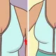 브라 속옷에서 삐져나오는 겨드랑이 쪽 지방이 있나요? 이와 관련된 유용한 정보를 소개해 드립니다