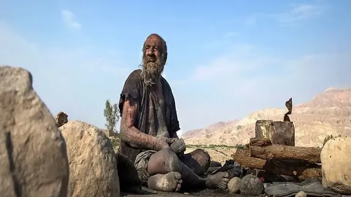 Ewww! This Man Hasn’t Taken A Bath In 65 Years