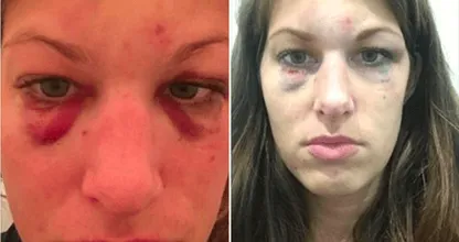 Deze vrouw wordt in elkaar geslagen door haar buurman en ZO gaat de politie ermee om.. Dit is toch schandalig? Delen svp!