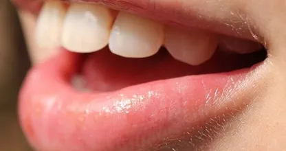 This is how you can soothe a burnt tongue within 10 seconds