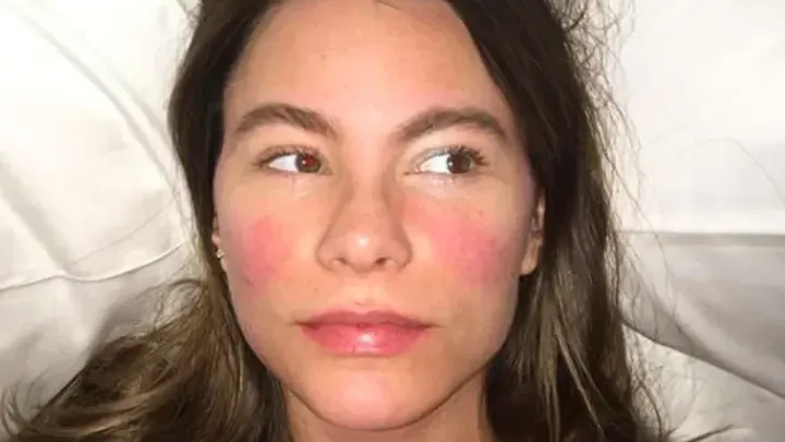 Antes del Glam Squad: Mira cómo lucen realmente estas celebridades