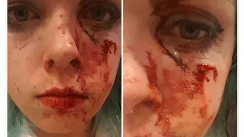 Daders van deze laffe mishandeling gezocht! Help met zoeken door mee te delen!