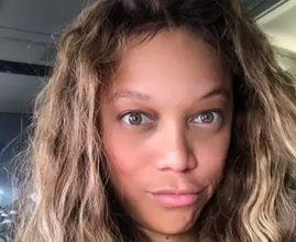 Before The Glam Squad: See How These Top Celebs Really Look!