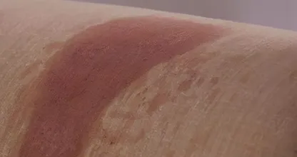 Spilled something on your sofa? With this simple solution it'll look as good as new again!