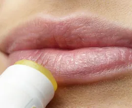 7 waarschuwingssignalen die lippen je vertellen over je gezondheid