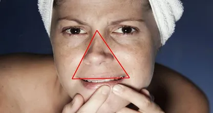 Pickel ausdrücken ist etwas gefährlicher als du dachtest...