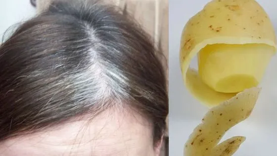 ¿Tienes canas? Entonces deberías hacer esto con rebanadas de papa