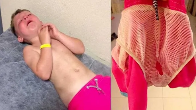 Wichtiger Hinweis für Eltern: Diese Badebekleidung kann deinem Kind ernsthaft wehtun!