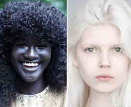 20 pessoas com características genéticas únicas difíceis de esquecer