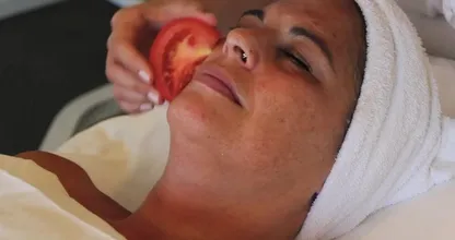 Wow! Rub a slice of tomato on your face and THIS could be the result! Amazing!